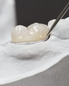 Коронки из безметалловой керамики