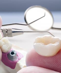 Временные, металлоакриловые (пластмассовые) коронки