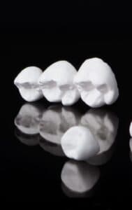 Металлические коронки