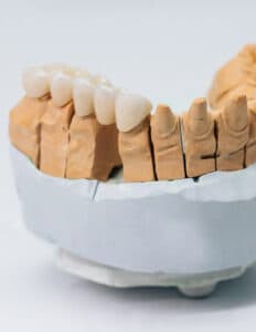 Съемные зубные протезы